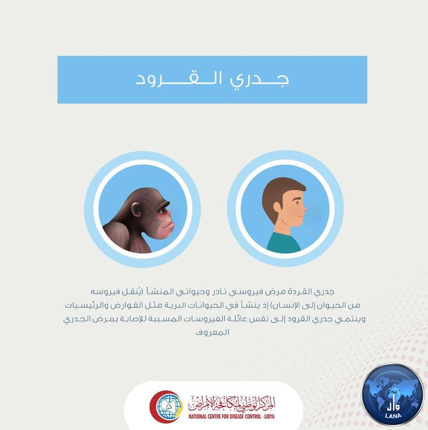 المركز الوطني لمكافحة الأمراض يُعلن خلو ليبيا من مرض جدري القرود